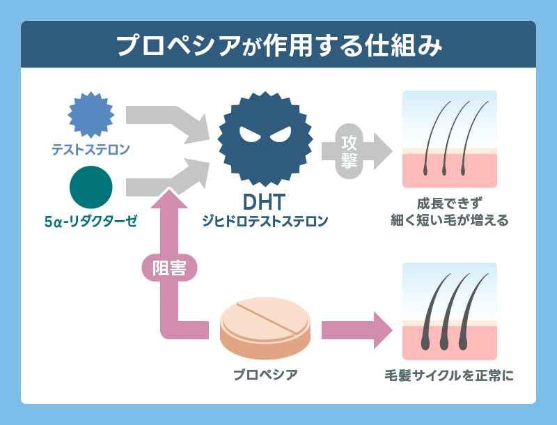 プロペシア やめてよかった AGA 仕組み