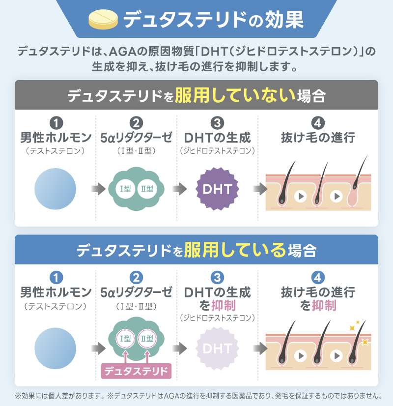 デュタステリド 通販 効果