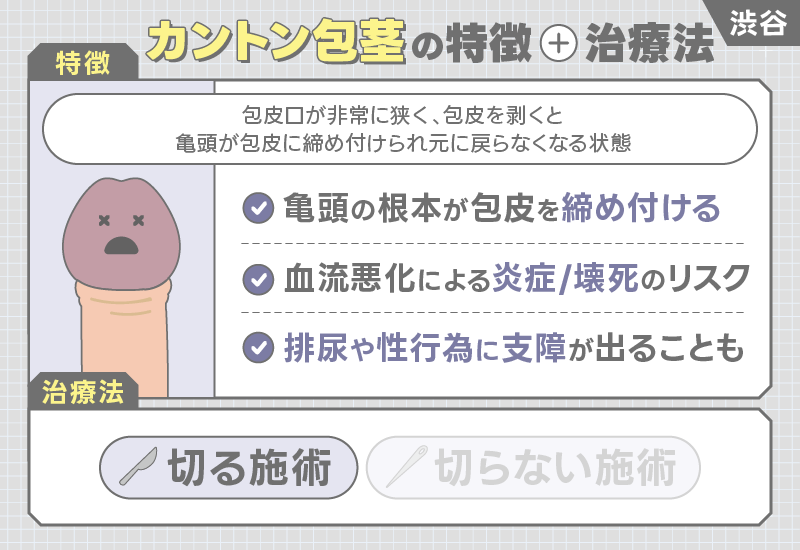 渋谷 包茎手術 カントン包茎