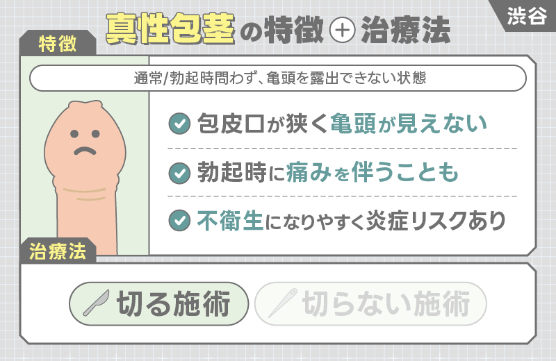 渋谷 包茎手術 真性包茎