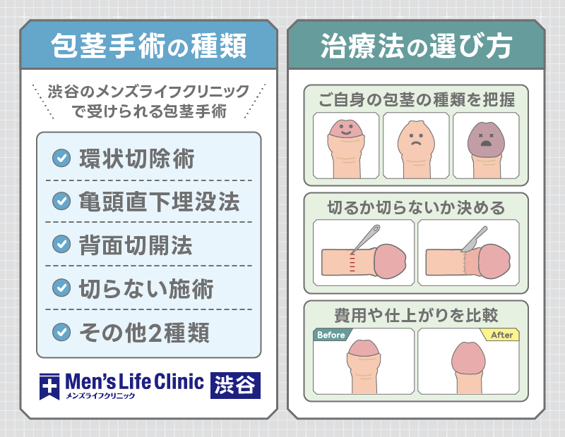 渋谷 包茎手術 選び方