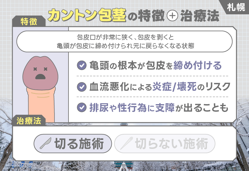 札幌 包茎手術 カントン包茎