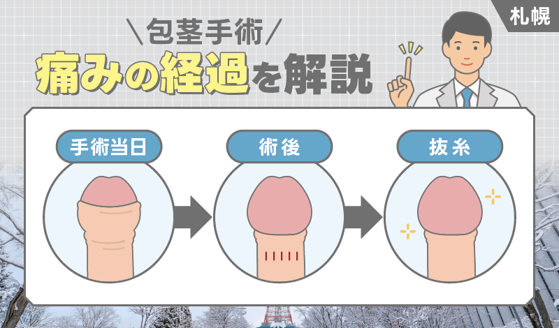 札幌 包茎手術 経過
