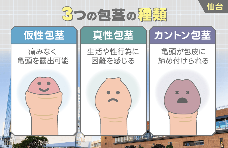 仙台 包茎3種類