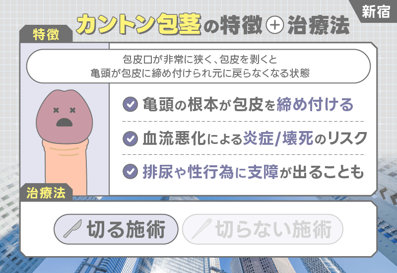 新宿 包茎手術 カントン包茎