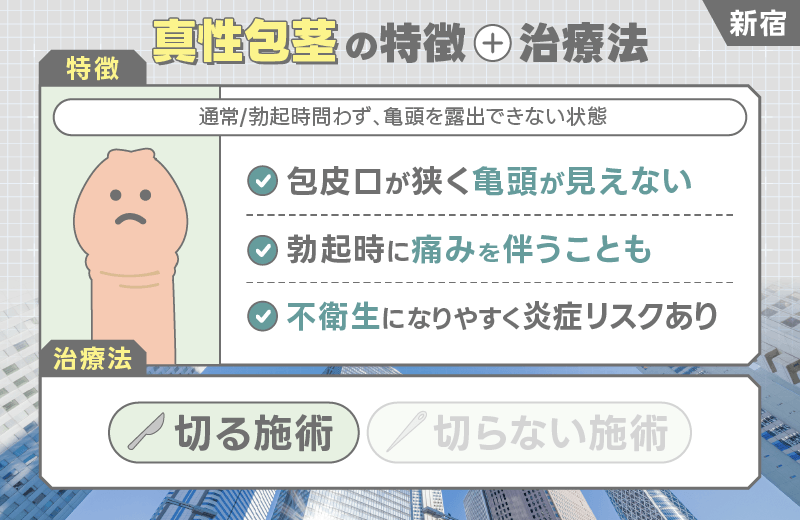 新宿 包茎手術 真性包茎